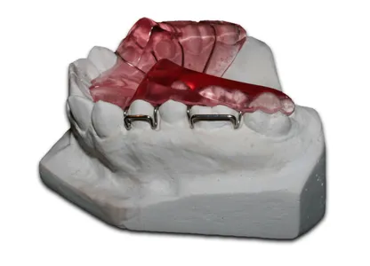 Functional Appliances